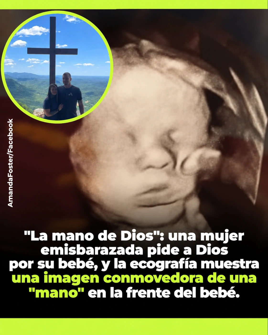 Ecografía de Kyler y fotografía de Amanda Foster junto a su pareja
