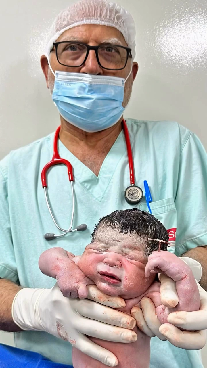 Matheus Gabriel después del parto, sostenido por un profesional de salud, con el DIU en su mano